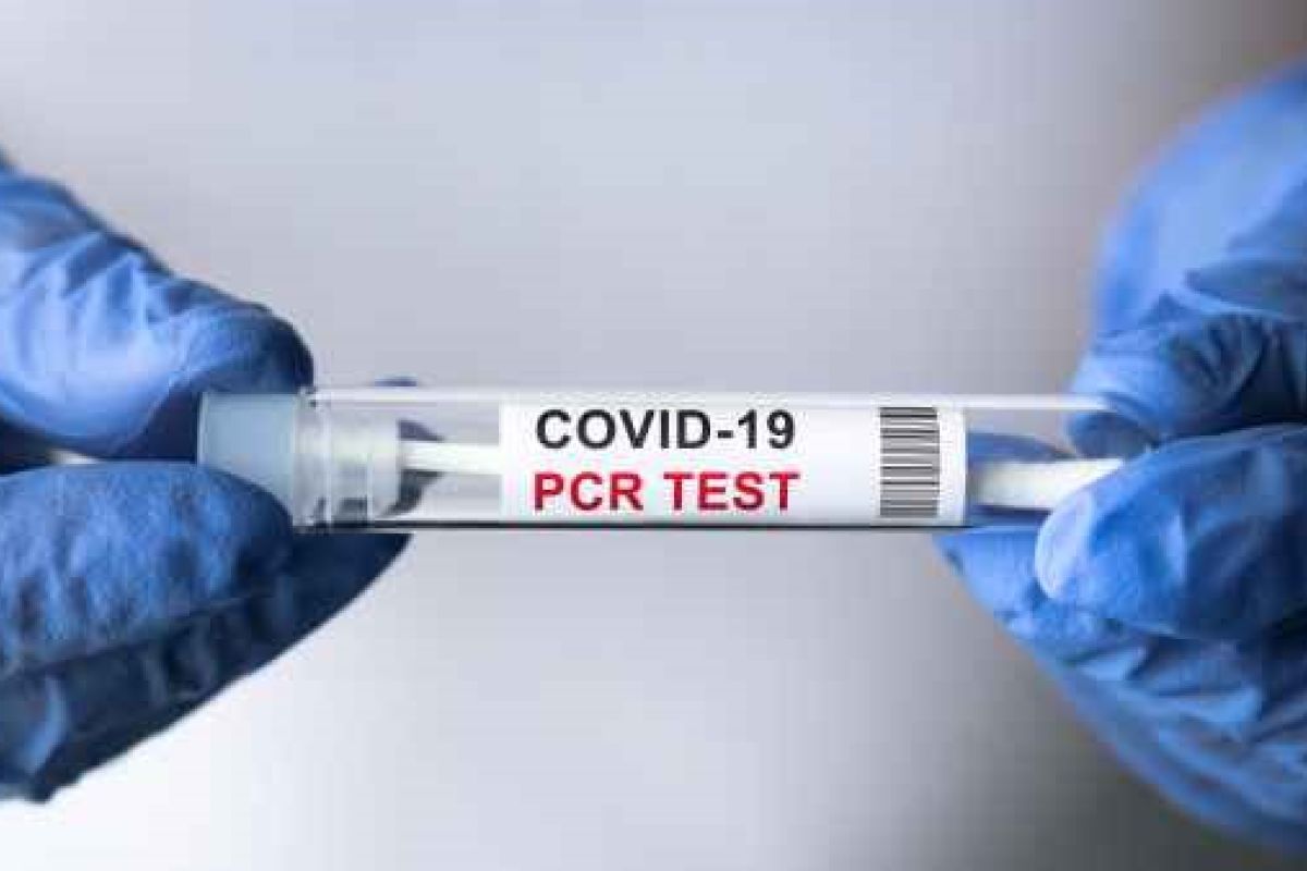 Wegfall der GOP 02402 /02403: Testverordnung ermöglicht Vergütung des hohen Aufwands bei PCR-Tests